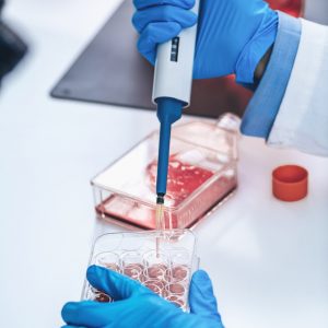 Biotechnology female researcher in laboratory working with cell culture